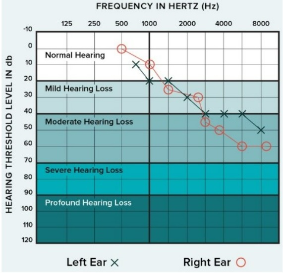 Audiogram graph